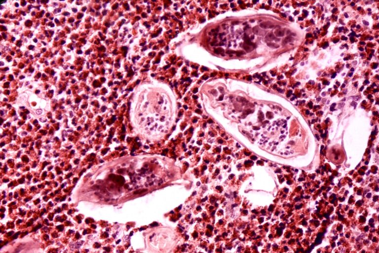 Ministry of Health, Wellness and Elderly Affairs Undertakes Public Awareness Efforts on Schistosomiasis