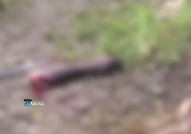 Man’s Arm Severed with Cutlass in Shocking Coolie Town Altercation