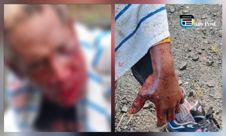 Man in Critical Condition After Venomous Snake Bite